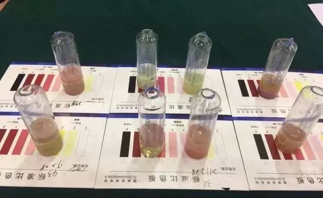 糖尿病肾病患者有哪些症状?日常生活中该如何注意?
