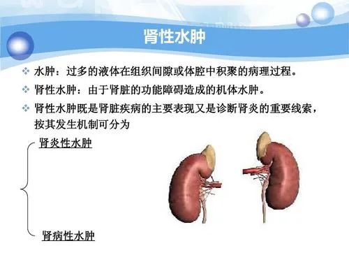 针对肾病综合症患者激素减量前要注意什么？