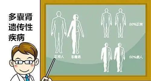 什么是多囊肾?都有哪些症状?