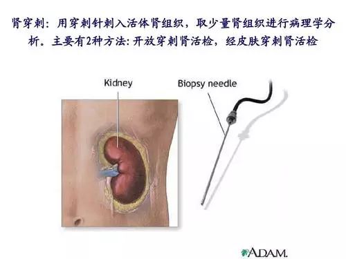 关于肾病的诊断分为哪几类?诊断依据(收藏)