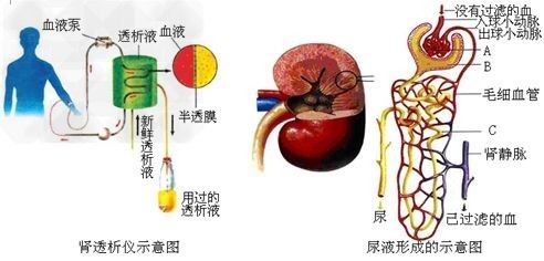 关于尿毒症透析及换肾的一些侃谈！如何避免？