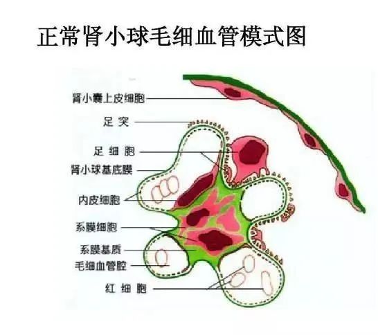 分析一下肾病患者尿蛋白和潜血怎样产生的?