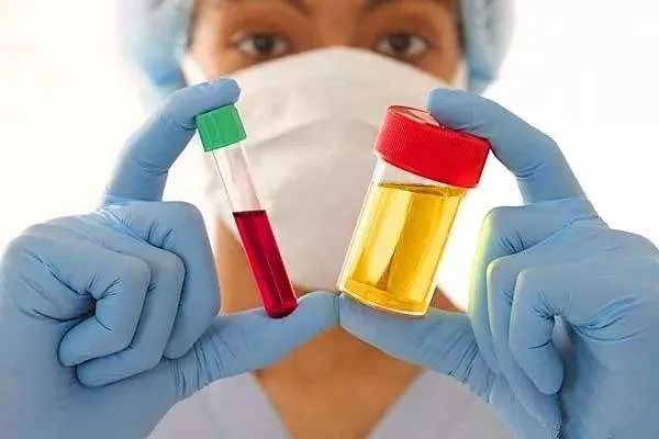 常用降尿酸药:别嘌醇、非布司他和苯溴马隆的区别以及注意事项有哪些?