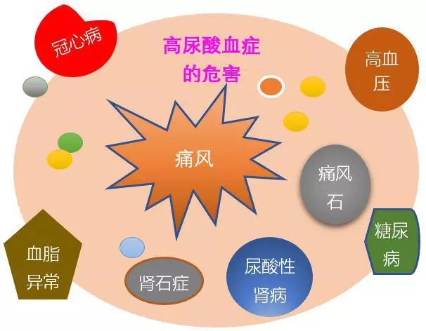 常用降尿酸药:别嘌醇、非布司他和苯溴马隆的区别以及注意事项有哪些?
