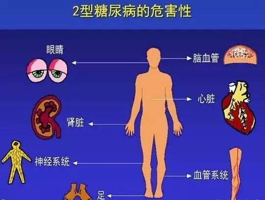 糖尿病性肾病症状有哪些?应该注意些什么?