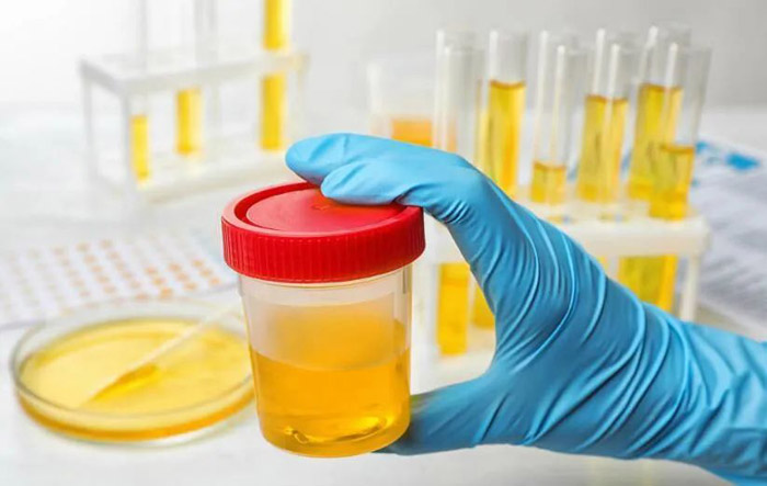 肾病究竟能否逆转?看完这篇文章应该会对你有所帮助~~