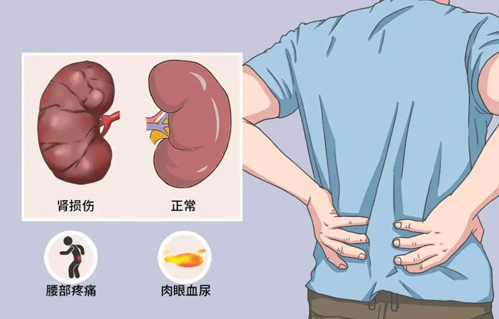 关于肾病的阴阳分型与治疗方案！